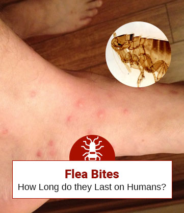 How Long Do Flea Bites Last? A Simple Guide